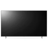 LED телевизор LG 65UP77006LB - фото 2