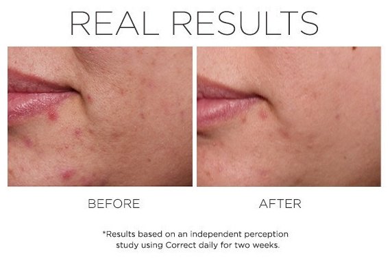 COSMEDIX сыворотка Clarity skin-clarifying для лица 30 мл купить,NaN