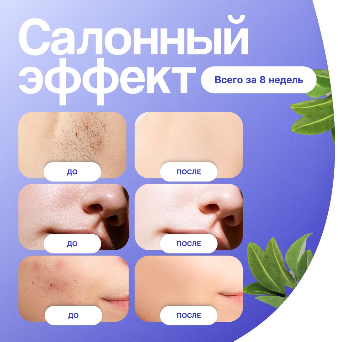 TAZADEM фотоэпилятор HAIR REMOVAL купить,30000