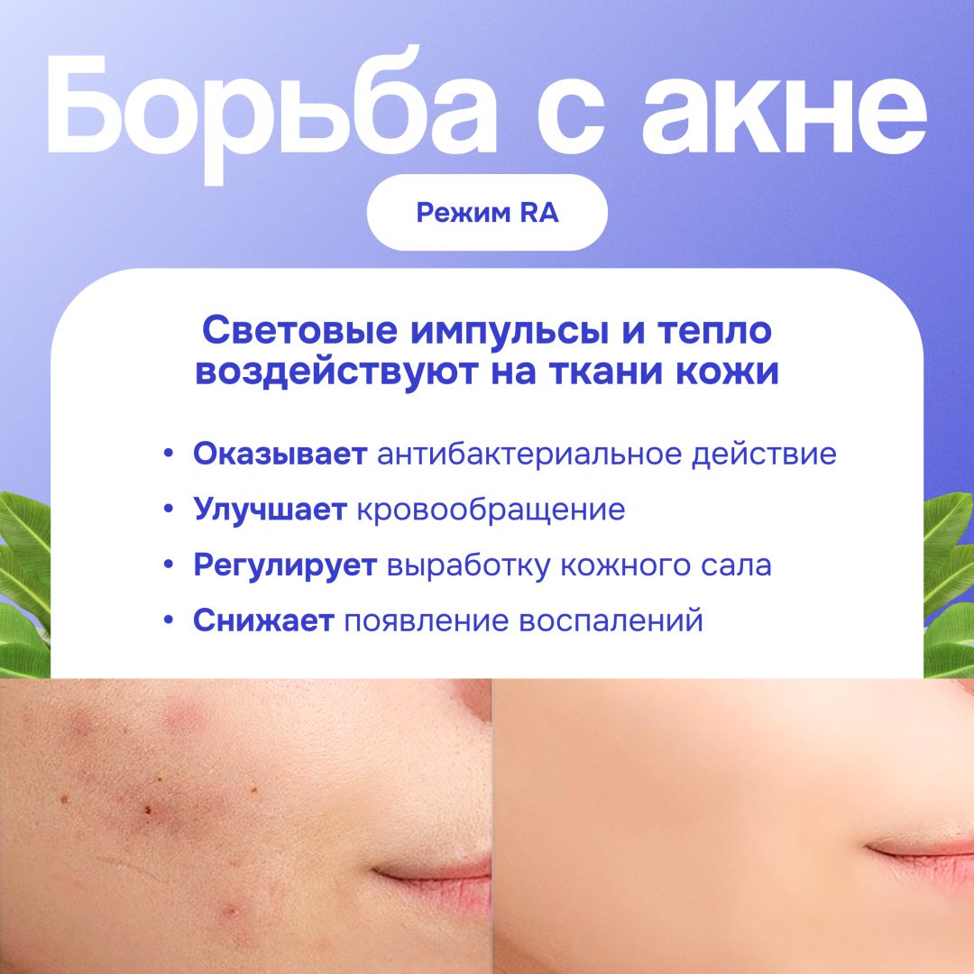 TAZADEM фотоэпилятор HAIR REMOVAL купить,30000