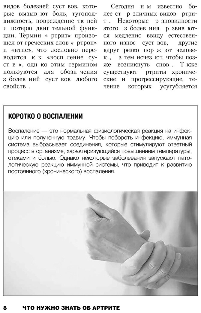 Книга Петерсон Л. Ш.: Жизнь без артрита: практическое руководство по избавлению от болей в суставах купить,NaN