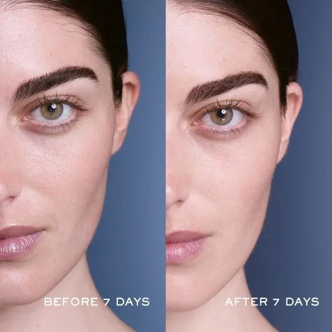 LANCOME сыворотка Genifique для лица 75 мл купить,79990