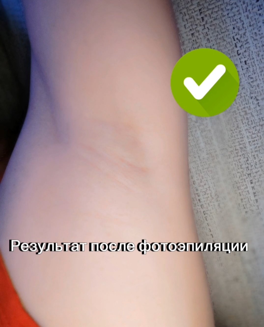 AIKO фотоэпилятор LM-C29 Pro - ForteMarket AIKO фотоэпилятор LM-C29 Pro купить,0