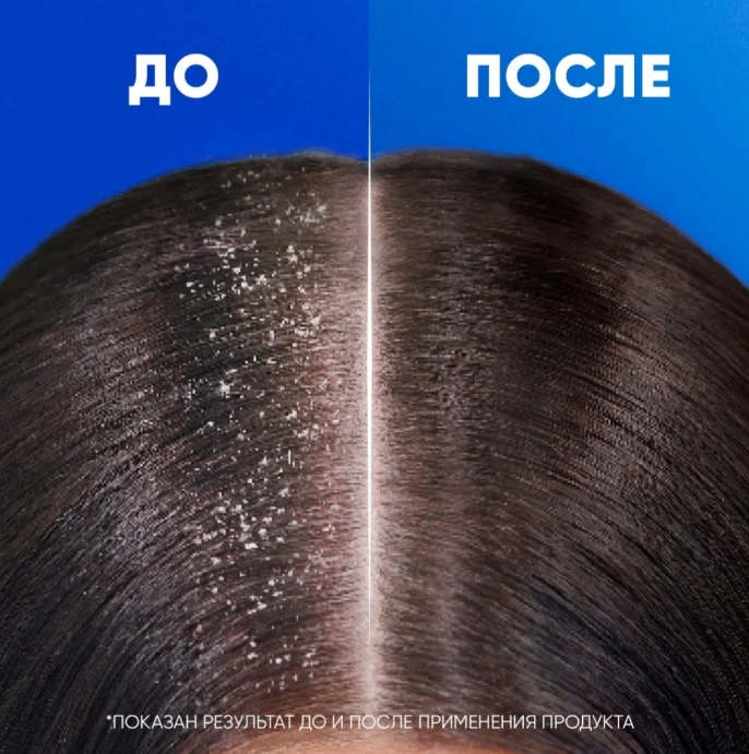 Шампунь Head&Shoulders 2в1 Комплексный уход 360мл купить,NaN