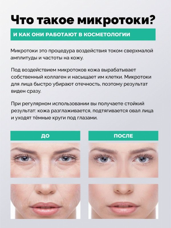 GESS микротоковый массажер купить,NaN