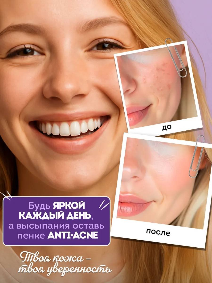Touch for you Анти-акне пенка 150 мл купить,NaN