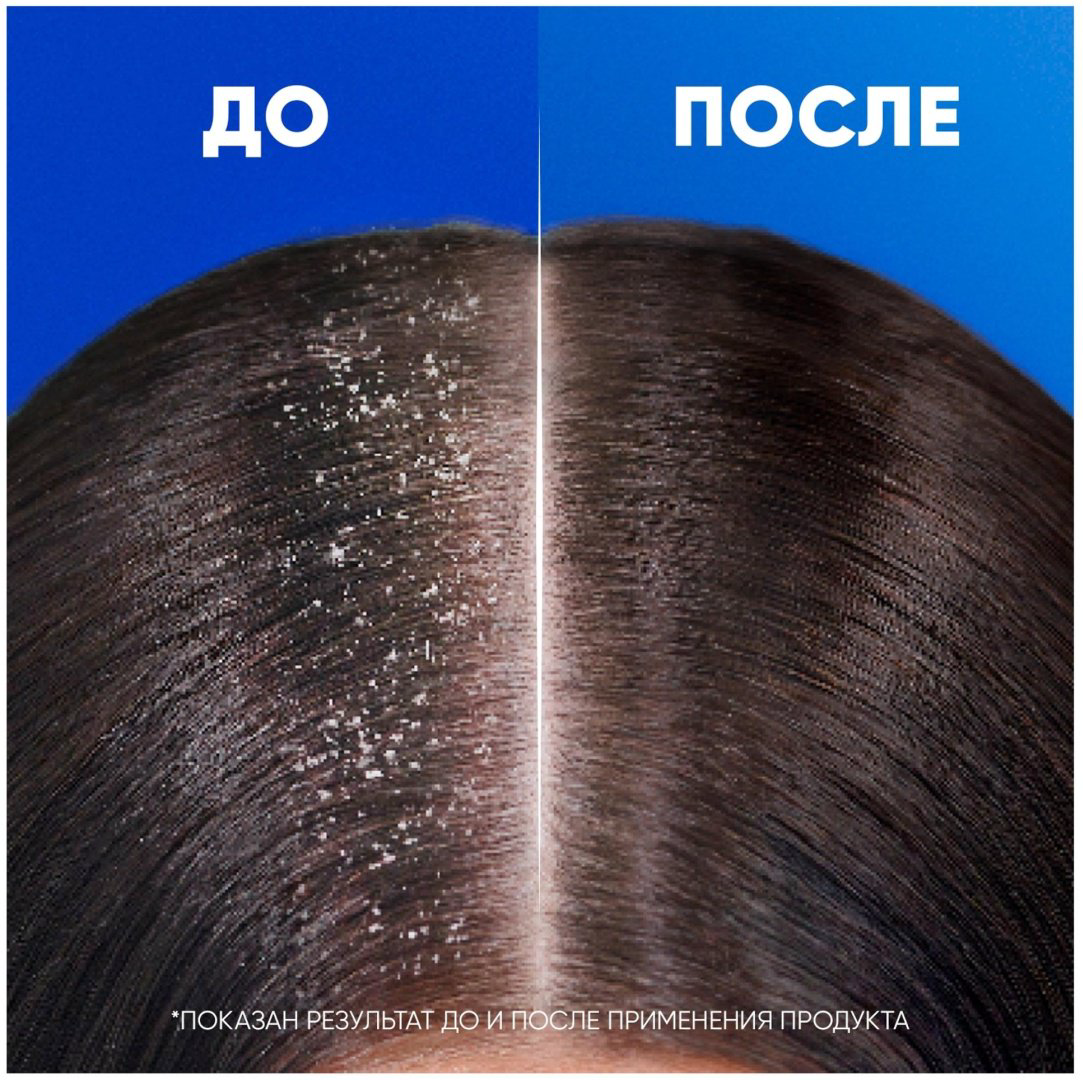 Head&amp;Shoulders Ментол 2 в 1 шампунь 400 мл купить,NaN