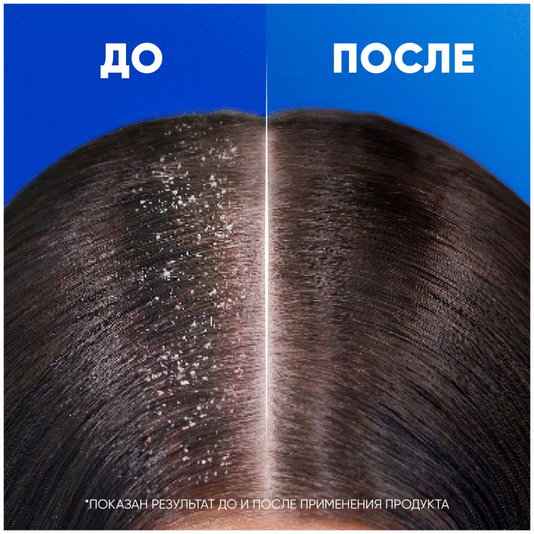 Head&amp;Shoulders Ментол шампунь 200 мл купить,0