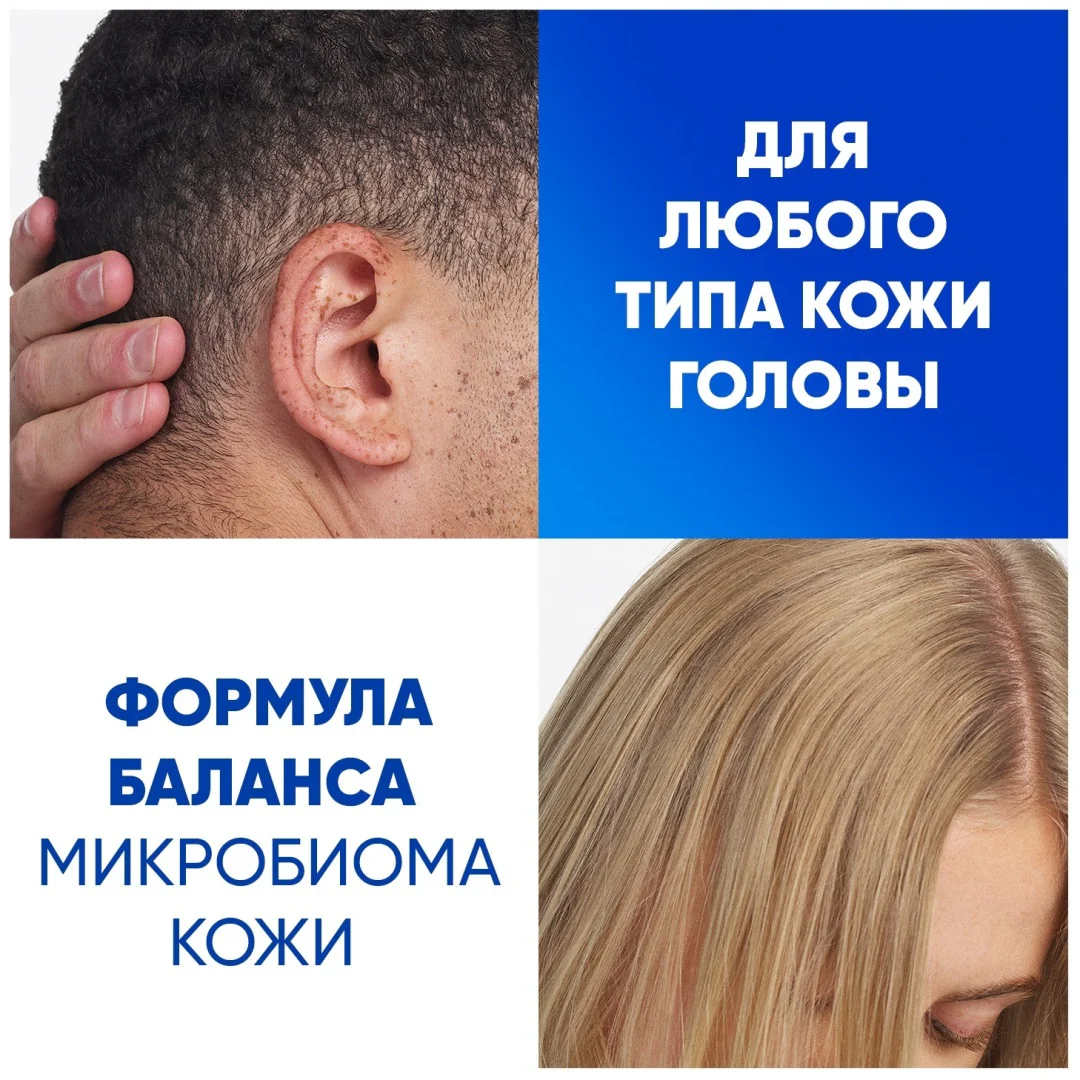 Шампунь Head&Shoulders против перхоти и увлажняющий уход 360 мл купить,NaN