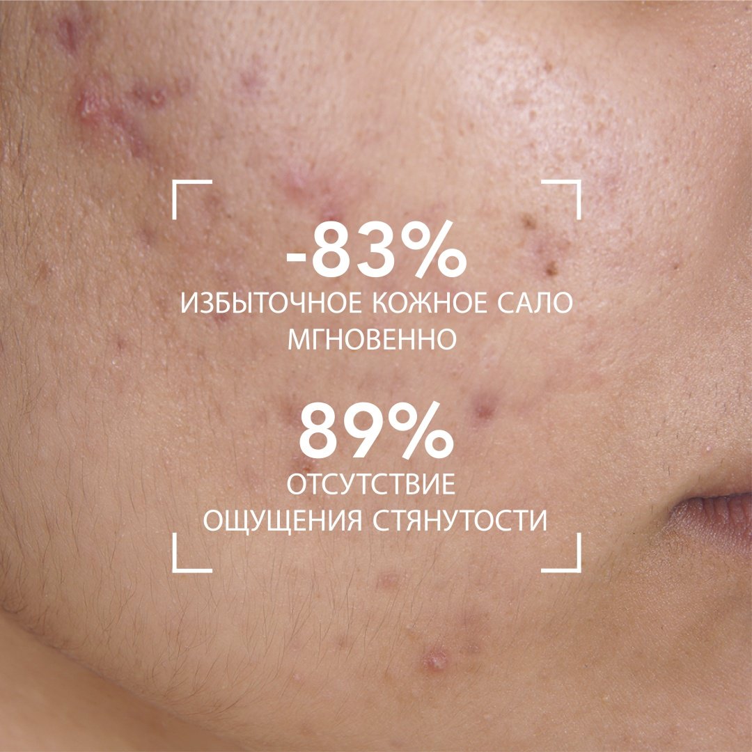 Bioderma Sebium Moussant гель 100 мл купить,NaN