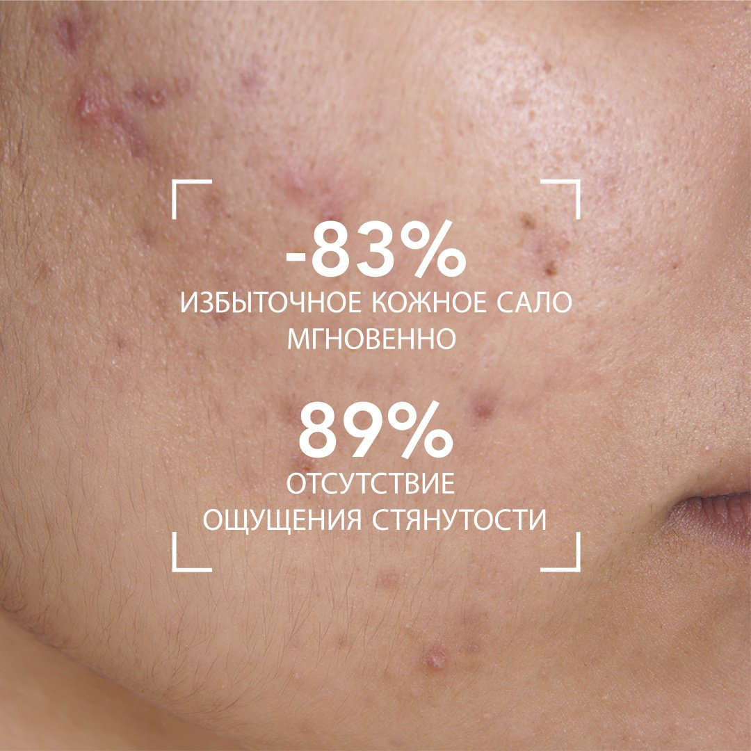 Bioderma Sebium Moussant гель 100 мл купить,NaN