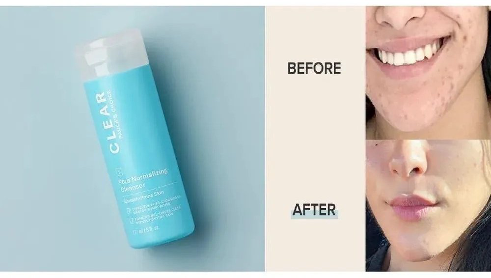 Paula's Choice Clear Pore Normalizing пенка 177 мл купить,NaN