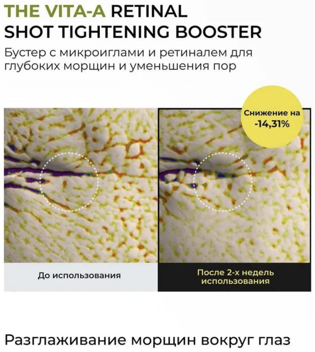 Celimax Ретиноловый лифтинг комплекс набор набор по уходу за лицом унисекс купить,function inputValueFn(){if((0,signal2.mK)(node),node.value===REQUIRED_UNSET_VALUE)throw new root_effect_scheduler.buA(-950,null);return node.value}