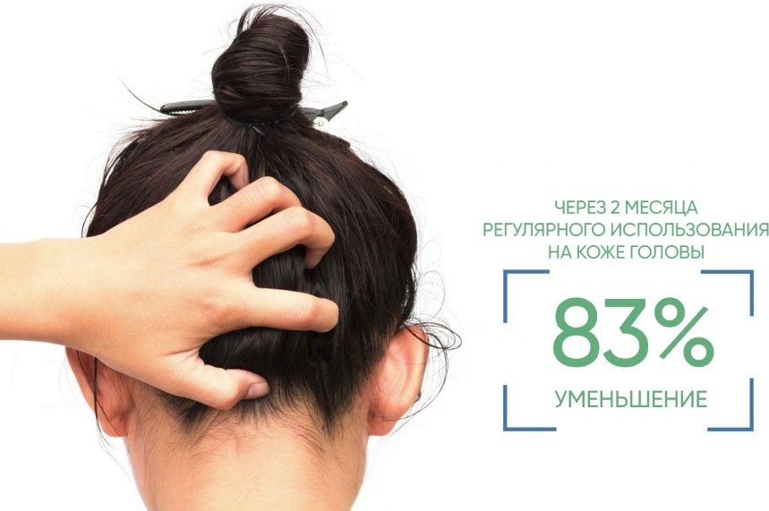 Bioderma Node DS+ для лечения шампунь 125 мл купить,NaN