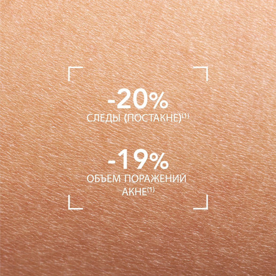 Bioderma крем-гель Sebium Kerato для лица 30 мл - ForteMarket Bioderma крем-гель Sebium Kerato для лица 30 мл купить,NaN