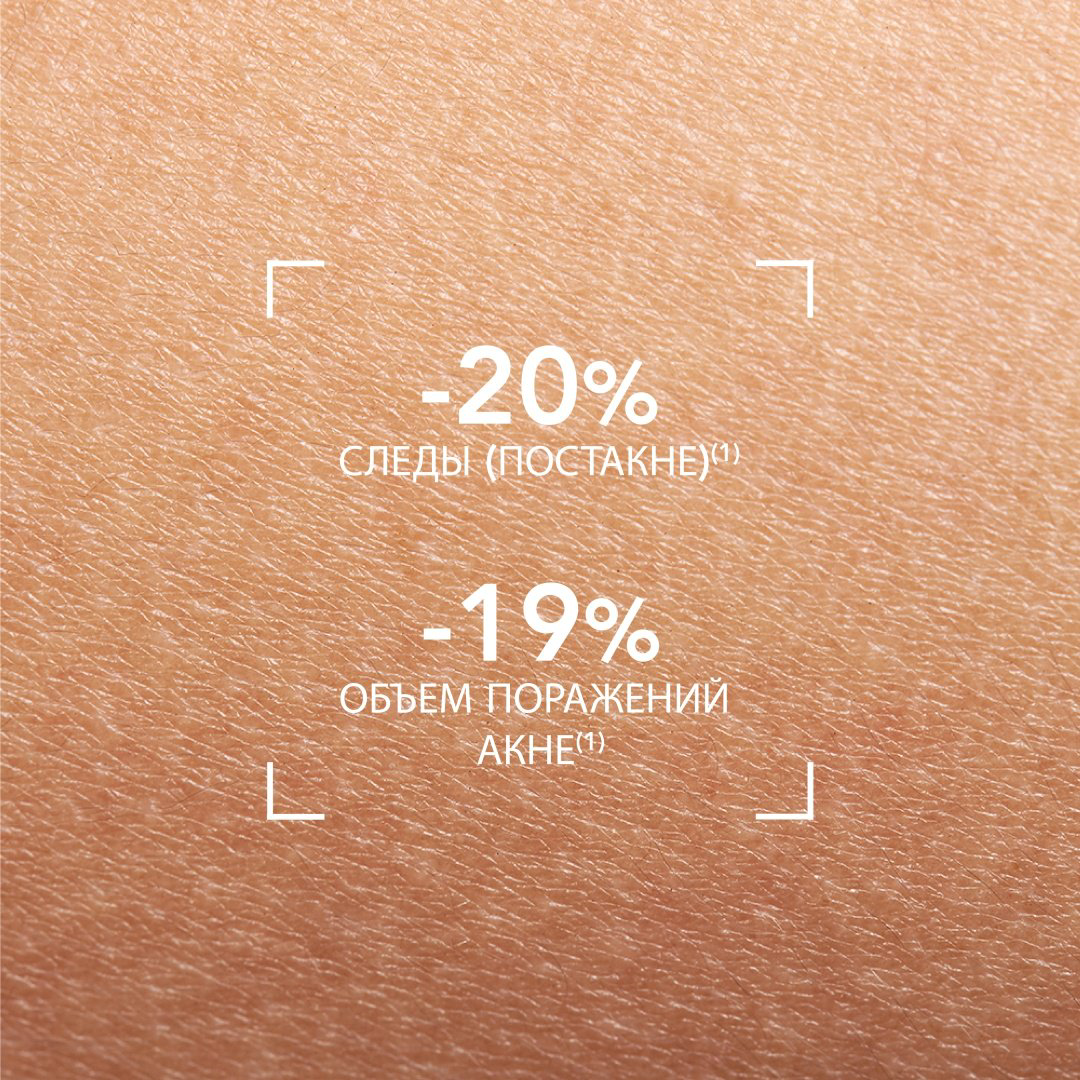 Bioderma крем-гель Sebium Kerato для лица 30 мл - ForteMarket Bioderma крем-гель Sebium Kerato для лица 30 мл купить,NaN