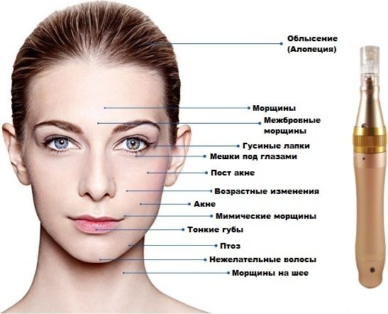 Dr.Pen дермапен купить,NaN