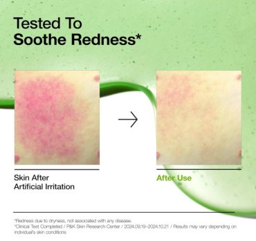 Anua сыворотка Azelaic Acid 10 Hyaluron для лица 30 мл купить,NaN
