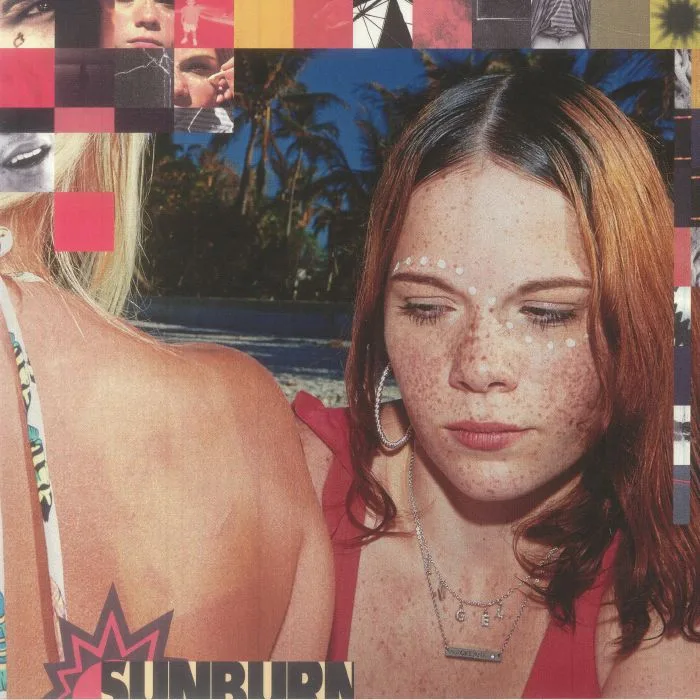 Dominic FIKE — Sunburn