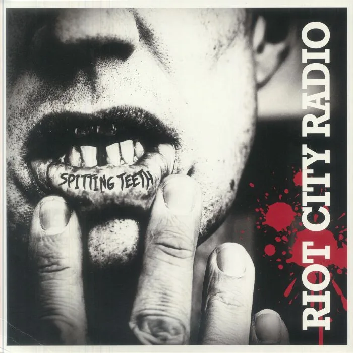 RIOT CITY RADIO — Spitting Teeth
