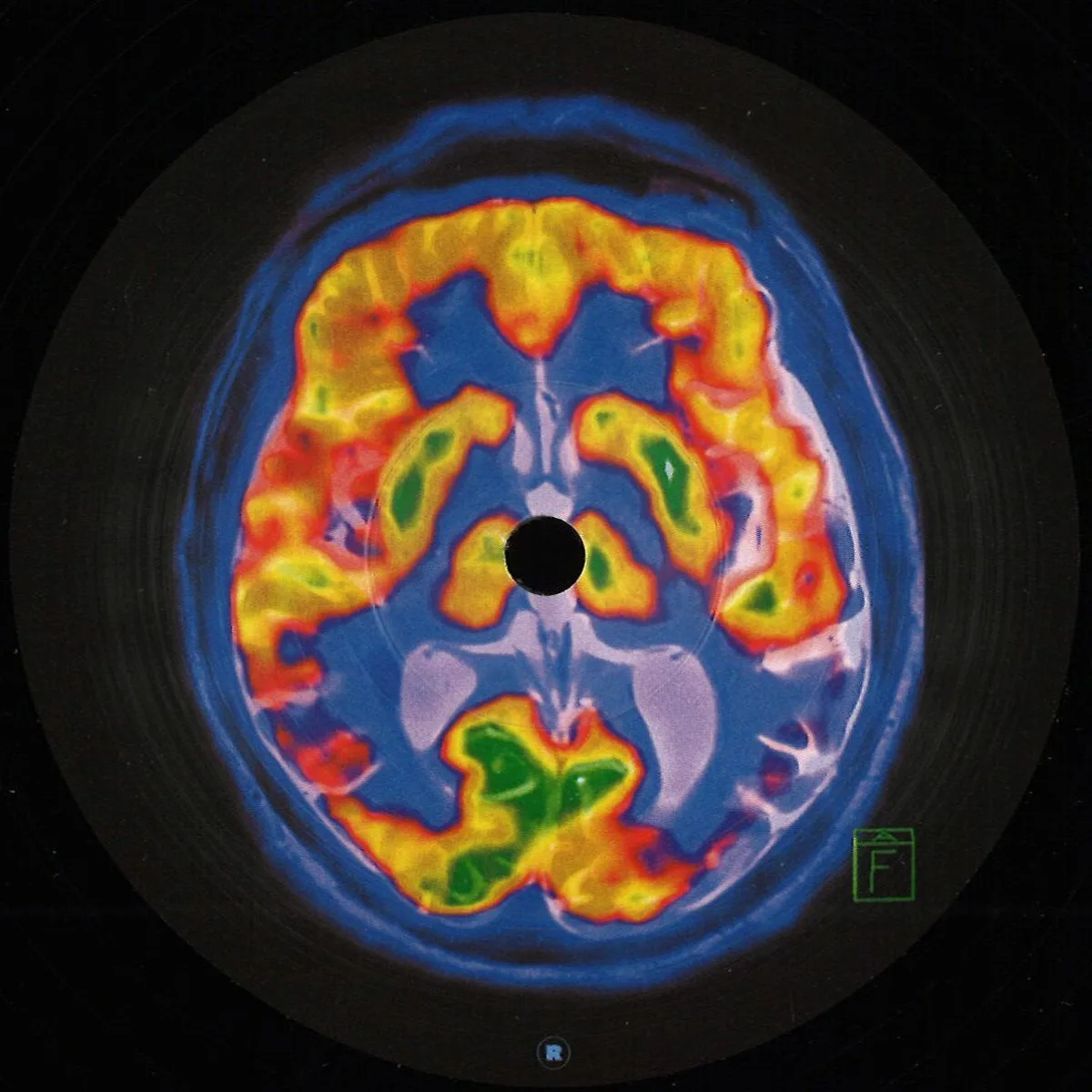 Frankey&Sandrino — Brainscan EP