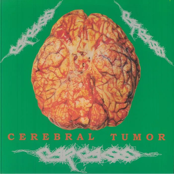 CARCASS — Cerebral Tumor: Brain Washing At Live Station Dortmund Germany 30 / 07 / 90