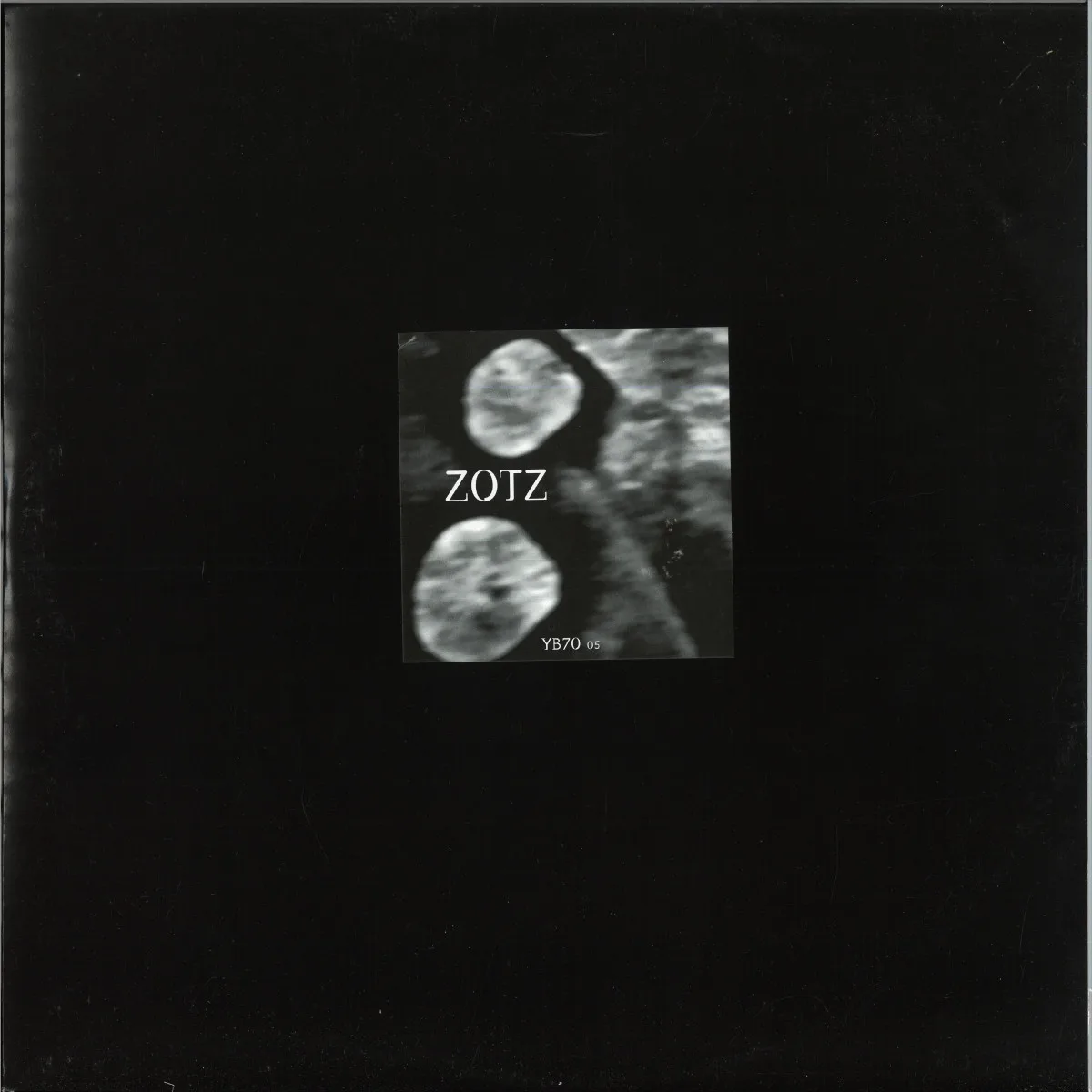 Zotz — Dual / W.I.M.M.