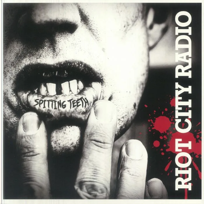 RIOT CITY RADIO — Spitting Teeth